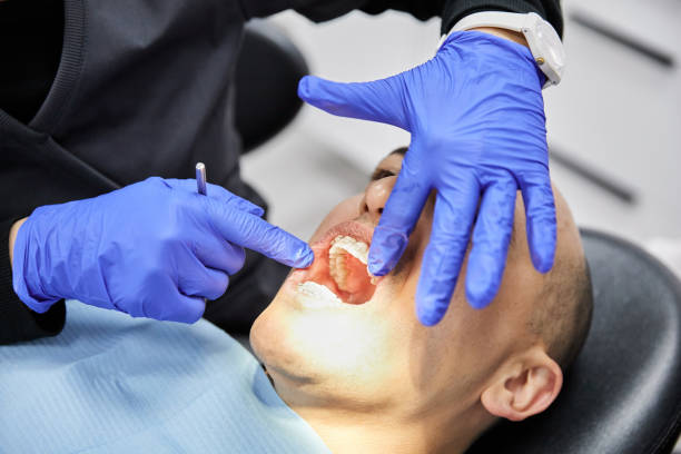 Best Emergency Dentist for Knocked-Out Tooth in Sunnyside, WA